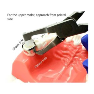 Gdc Posterior Band Remover