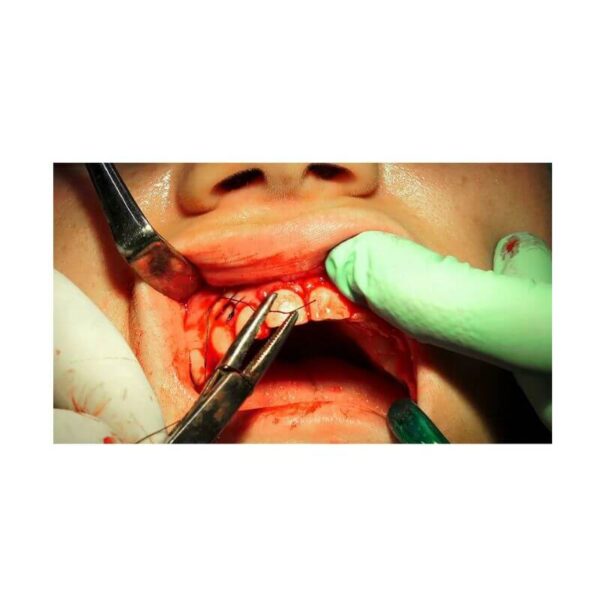 GDC Needle Holder Adson (Nha)